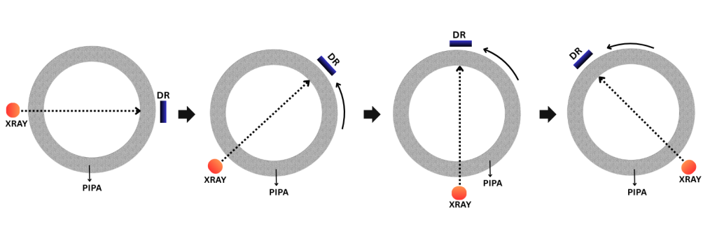 Pipa_DR_digital radiography